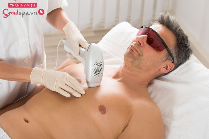 Triệt lông cho nam bằng Elight cho hiệu quả lâu dài và an toàn