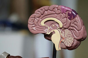 brain_mid.jpg