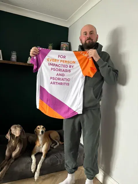 Jack proudly shows off his Psoriatic Disease UK running shirt