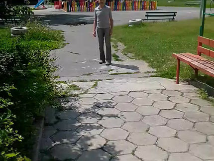 Смяна на колянна става.