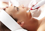 Microneedling