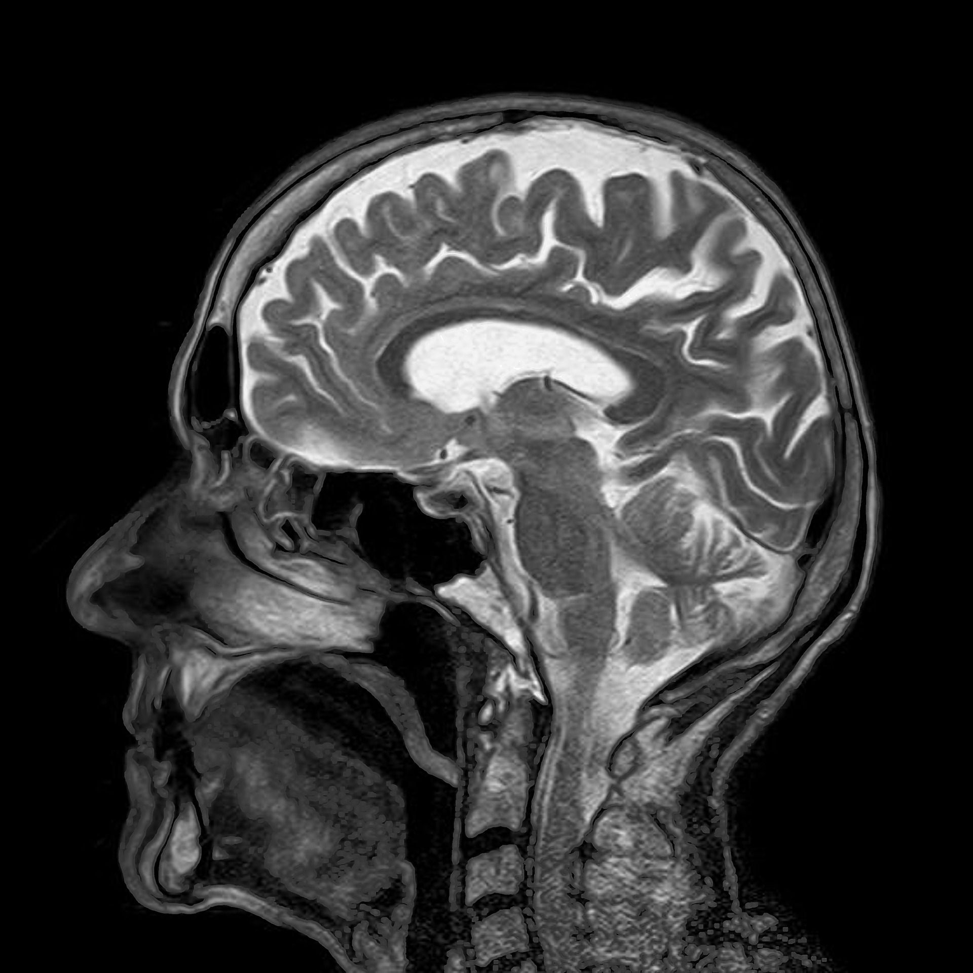 MRI MOCK REGISTRY