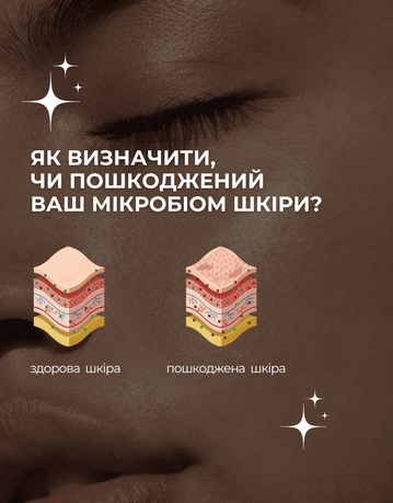 Як визначити, чи пошкоджений ваш мікробіом шкіри?