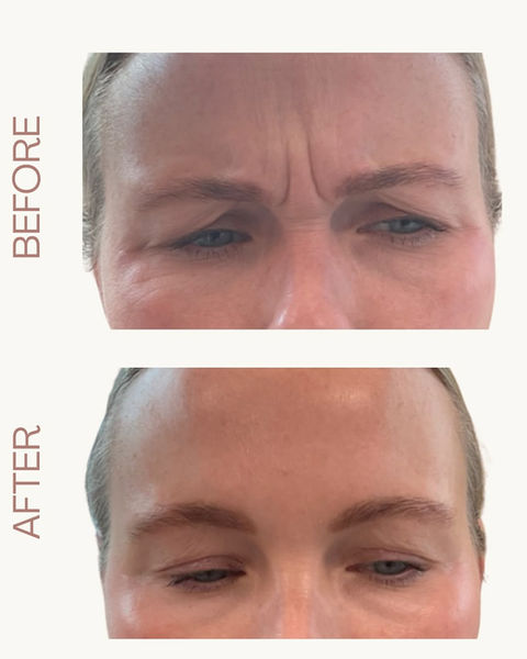 Best Med Spa Wilmington NC For Botox Injections