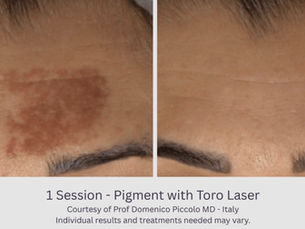 Pigmentation Correction Treatment near me Wilmington nc