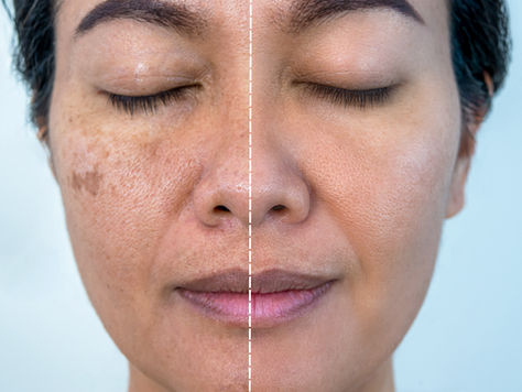 hydrafacial near me Wilmington NC