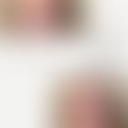 #1 Botox cosmetic near me - Delaware