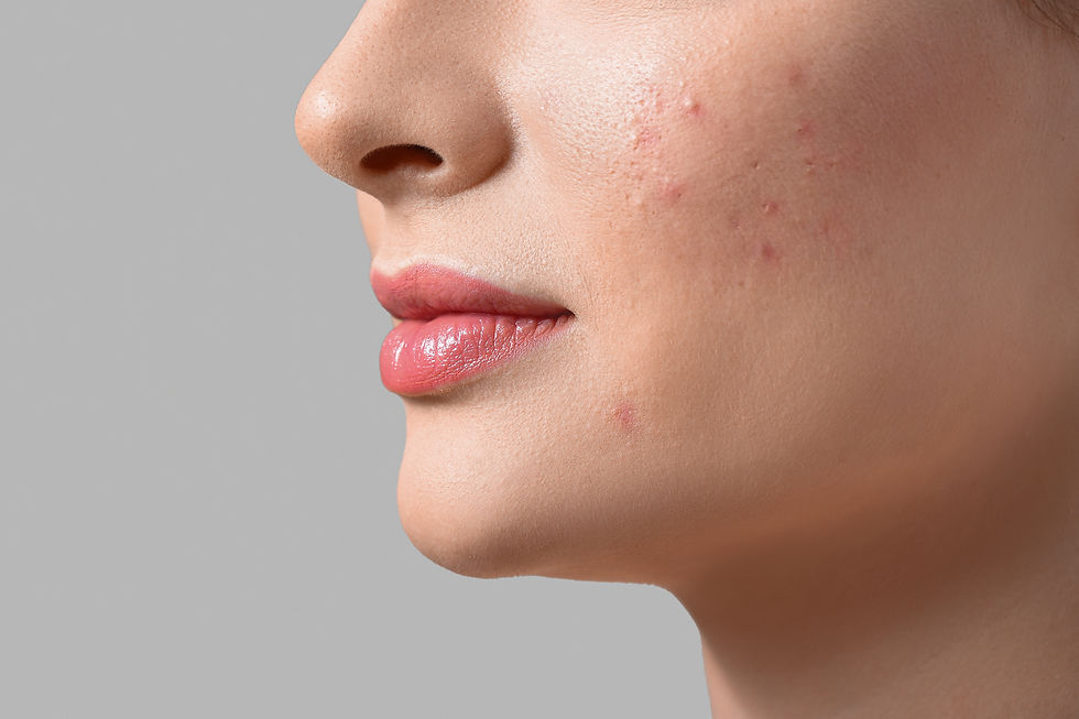 Close-up view of a skincare professional preparing a microneedling device in Wilmington NC