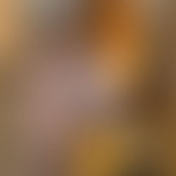 Why These Three Things Can Reverse Rheumatoid Arthritis Pain Without Medication