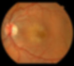 Toxoplasmosis I VRM Toronto