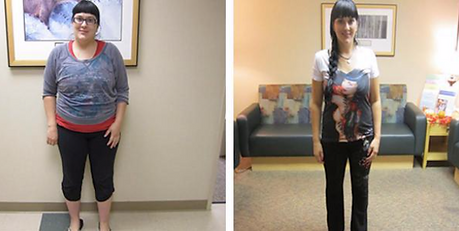 Dr Jeremy Korman - Gastric Sleeve Testimonial