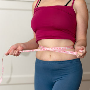 How to Reduce Scars After Weight Loss Surgery

