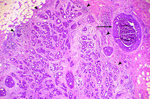 What’s the difference between a tumor and a cancer?