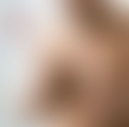 جراحة التثدي في تركيا: صدر مميز ورياضي