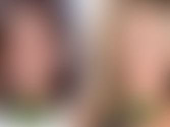 Jennifer Aniston Rhinoplastik vor und nach Gesichtstransformation zeigt subtile Nasenformung über die Jahre – ikonische Prominenten-Nasenoperation und Schönheitsoperationsreise