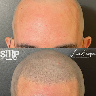 smp vancouver, hair tattoo