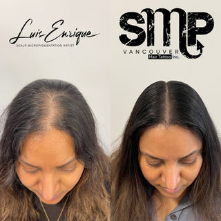 Long Hair SMP vancouver