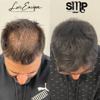 Long Hair SMP Vancouver