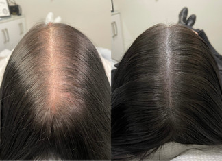 smp hair vancouver