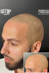 Hair tattoo