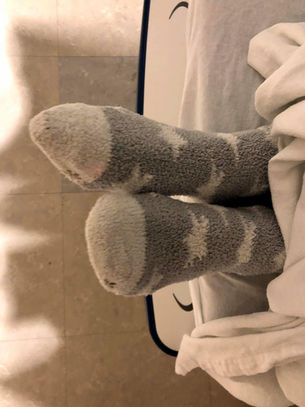 Recovery is no straight line