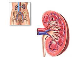 Qué es la insuficiencia renal?