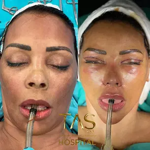 Case Study – Facial Plastic Surgery