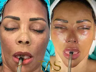 Case Study – Facial Plastic Surgery