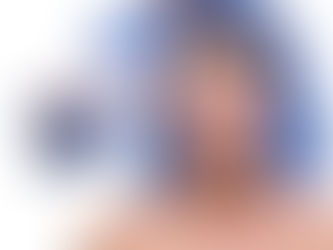 Erkeklerde Botulinum toxin Uygulaması