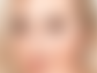 The Reasons of The Nasal Malformation