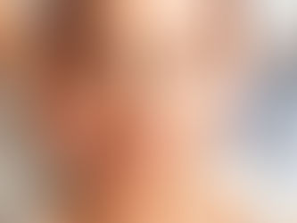 Hıfu Kalıcılığı Ne Kadar?