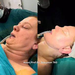 Case Study – Facial Cosmetic Surgery