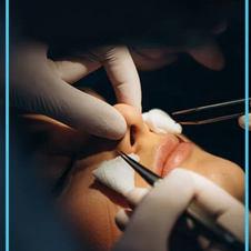 Expert Recommendations For The Best Rhinoplasty Experience