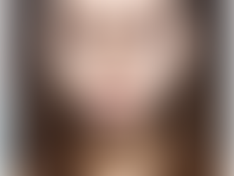 5 Important Factors For The Best Rhinoplasty Result