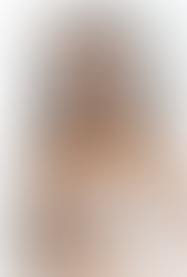 Pregnancy and Breast Aesthetic Surgeries