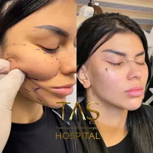 Case Study – Facial Surgery