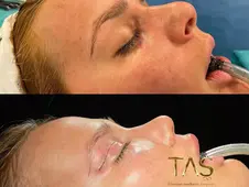 Case Study – Youthful facial appearance