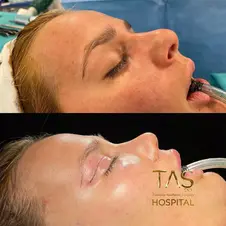 Case Study  – Youthful facial appearance