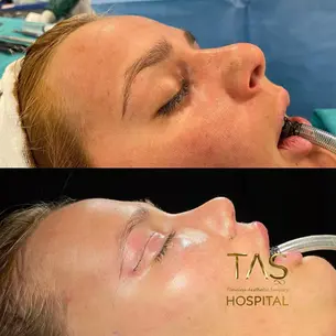 Case Study – Youthful facial appearance