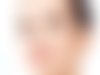 How a Rhinoplasty Can Help a Deviated Septum?