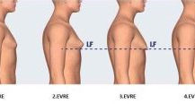 Male Breast Aesthetics (Gynecomastia)