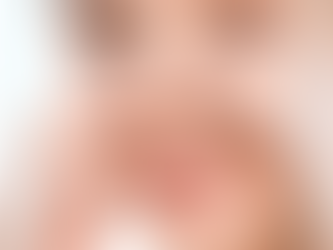 How Painful is Rhinoplasty?