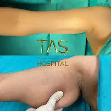 Case Sudy – Body Aesthetics