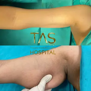 Case Sudy – Body Aesthetics