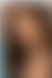 Am I a Good Candidate for a Rhinoplasty?