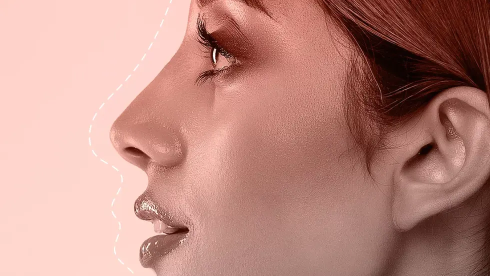 Is Your AI Nose Job Setting You Up For Disappointment?