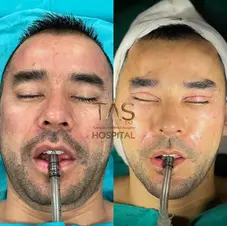 Case Study – Male Facial enhancements