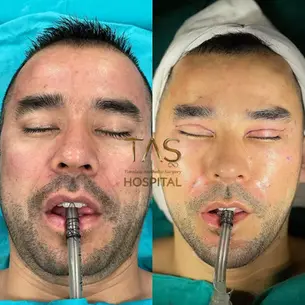 Case Study – Male Facial enhancements