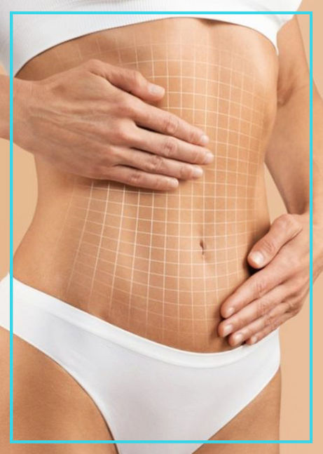 Everything about Stomach Liposuction