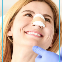 Tips to Speed Up Recovery After Rhinoplasty